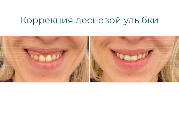 Результаты и эффект